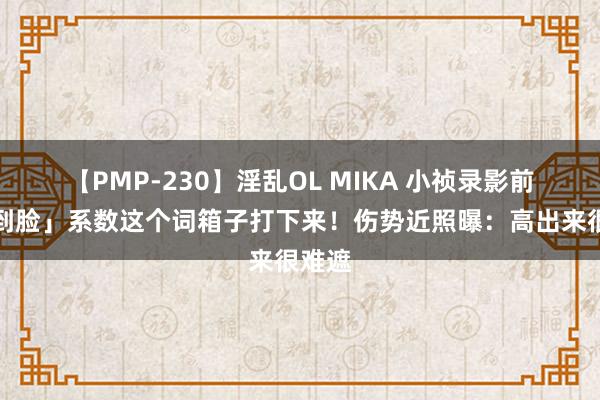 【PMP-230】淫乱OL MIKA 小祯录影前「撞到脸」系数这个词箱子打下来！伤势近照曝：高出来很难遮